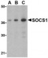 SOCS1 Antibody (N-Terminus)